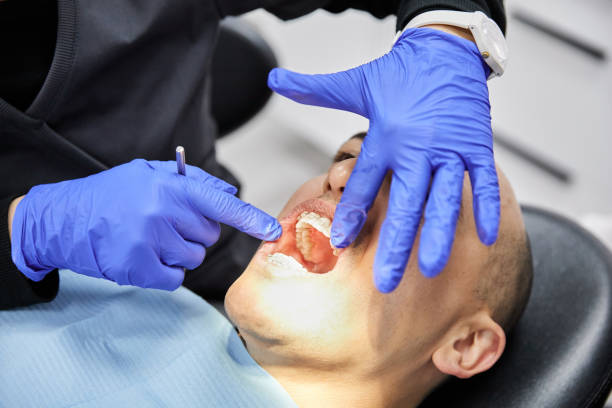 Best Emergency Dental Care for Sports Injuries in Perry, LA